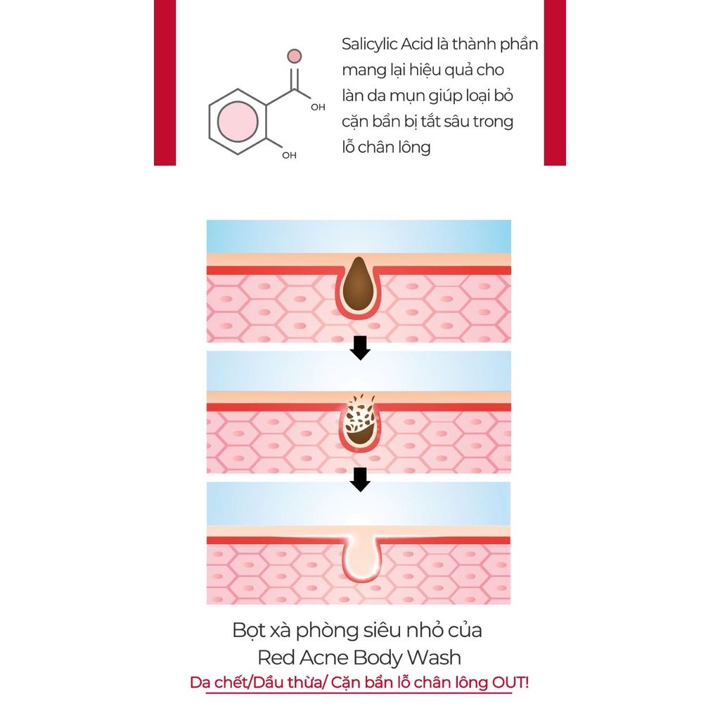 Sữa tắm cho da mụn Medicube Red Acne Body Wash