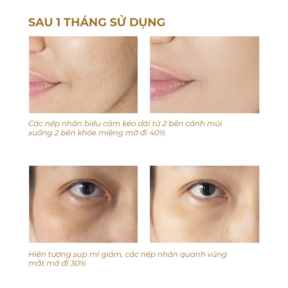 Bộ Trial Kit Menard Saranari tái tạo da bằng phương pháp tăng sinh collagen (38g)