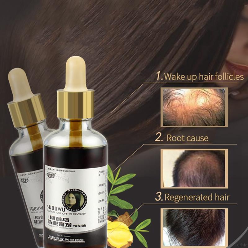 [Hàng mới về] Tinh dầu hà thủ ô đỏ nuôi dưỡng nang tóc và chống tóc rụng
