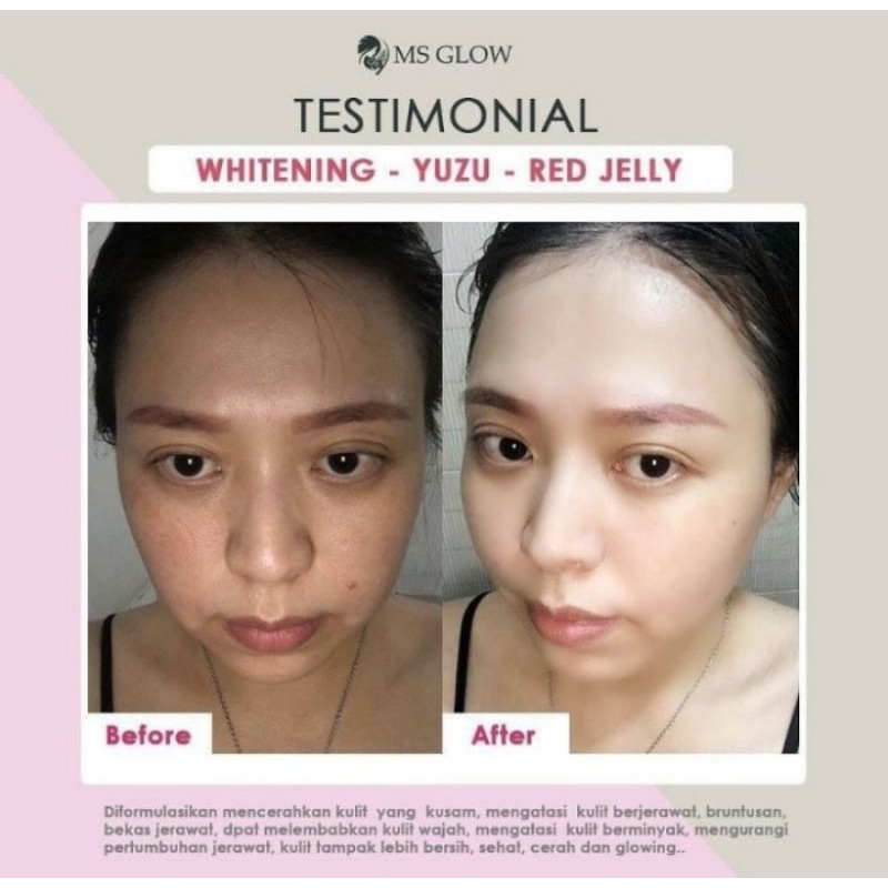 Ống Hút Mụn Phát Sáng Tối Thượng 2 Gói 100% Tiền Trở Lại | BigBuy360 - bigbuy360.vn