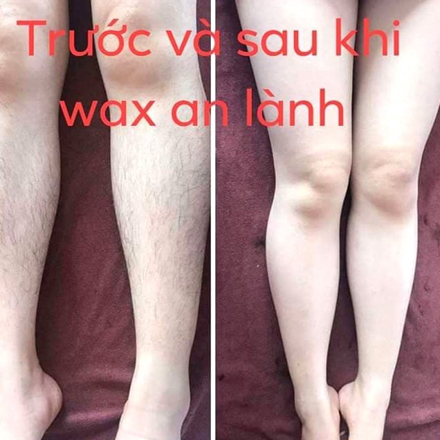 Wax lông An Lành tại nhà (tặng kèm giấy và que wax)