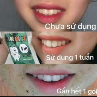 Banking soda NT