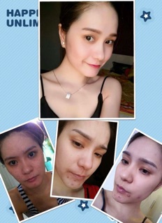 Cám gạo thảo dược