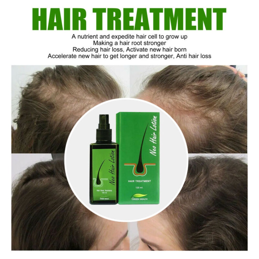 Hair Regrowth Lotion Haircare Hair Loss Oil Baldness Hair thinning 120ml Spray