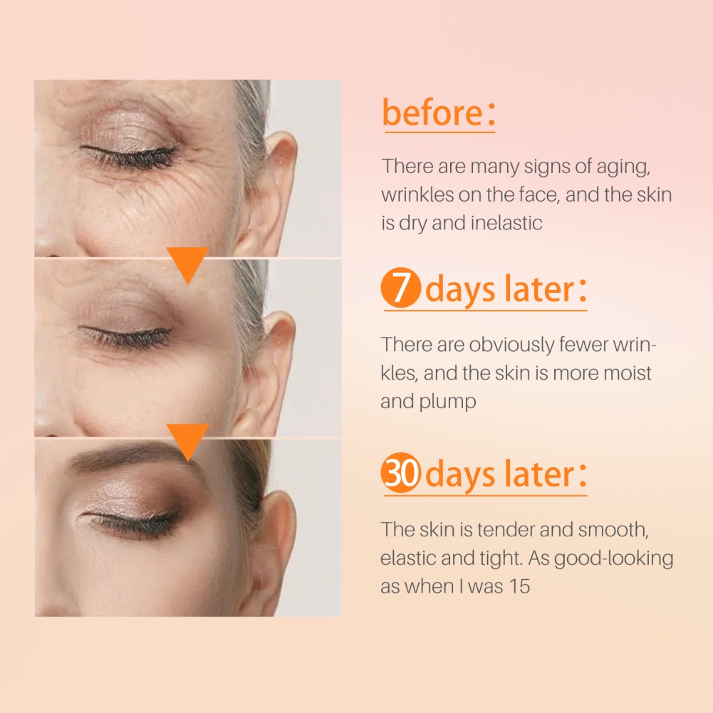 Huyết Thanh Retinol Huyết Thanh Dưỡng Ẩm Nuôi Dưỡng Và Làm Sáng Da Làm Mờ Nếp Nhăn Trên Khuôn Mặt Okase