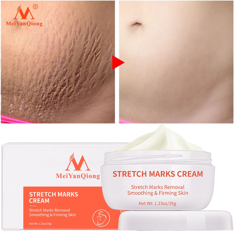 Meiyanqiong Stretch Mark Cream Làm Trắng Và Săn Chắc Mịn Mượt Chống Lão Hóa Giảm rạn da Kem dưỡng ẩm 35g