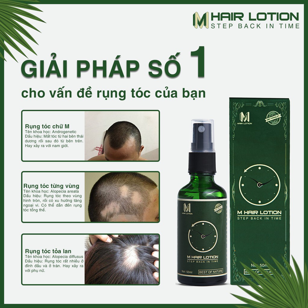 Tinh Dầu Mọc Tóc Nhanh M Hair Lotion 50ml | Ngăn Rụng Tóc | Không Dùng Với Tinh Dầu Bưởi Mọc Tóc Để Có Hiệu Quả Tốt Nhất | BigBuy360 - bigbuy360.vn