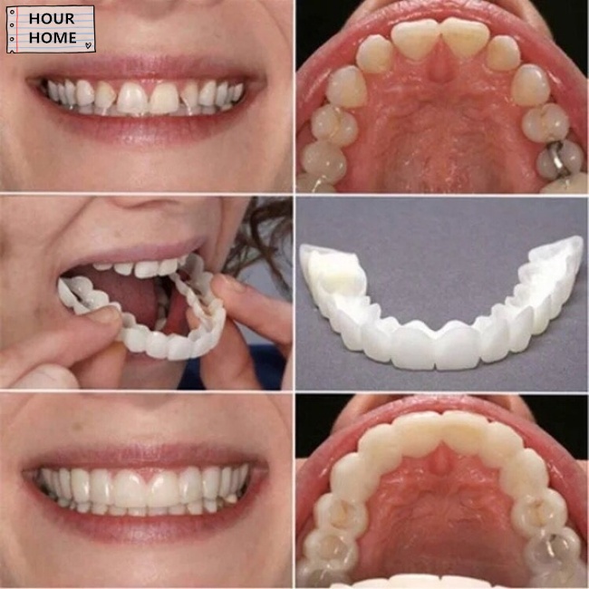 [Hàng mới về] Cặp miếng bọc răng hàm trên và hàm dưới tái sử dụng được đem lại hàm răng trắng sáng