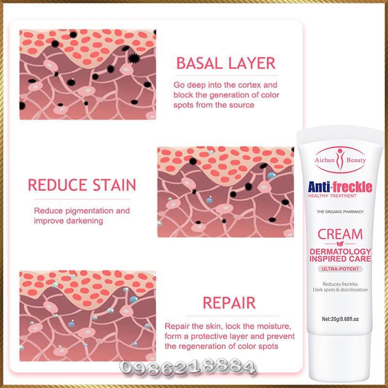 Kem xoá mờ tàn nhang Aichun Anti-freckle Cream A4696