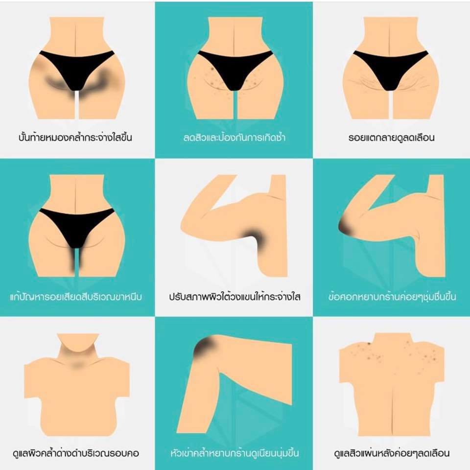 Combo 2 TUÝP NAKIZ LIVELY BUTT 〡 Kem thoa thâm Mông, Bẹn, Nách, Lưng, Nhũ hoa, Đầu gối, Cùi chỏ.... Thái Lan | BigBuy360 - bigbuy360.vn