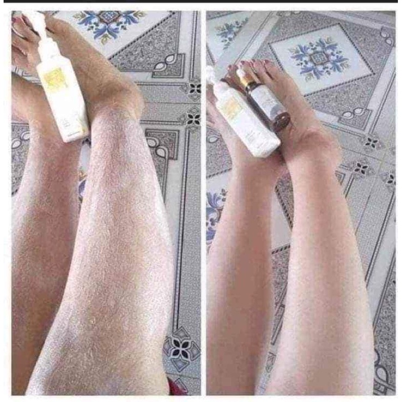 Kem tẩy lông Huyền Phi ( tặng kèm serum triệt lông vĩnh viễn)