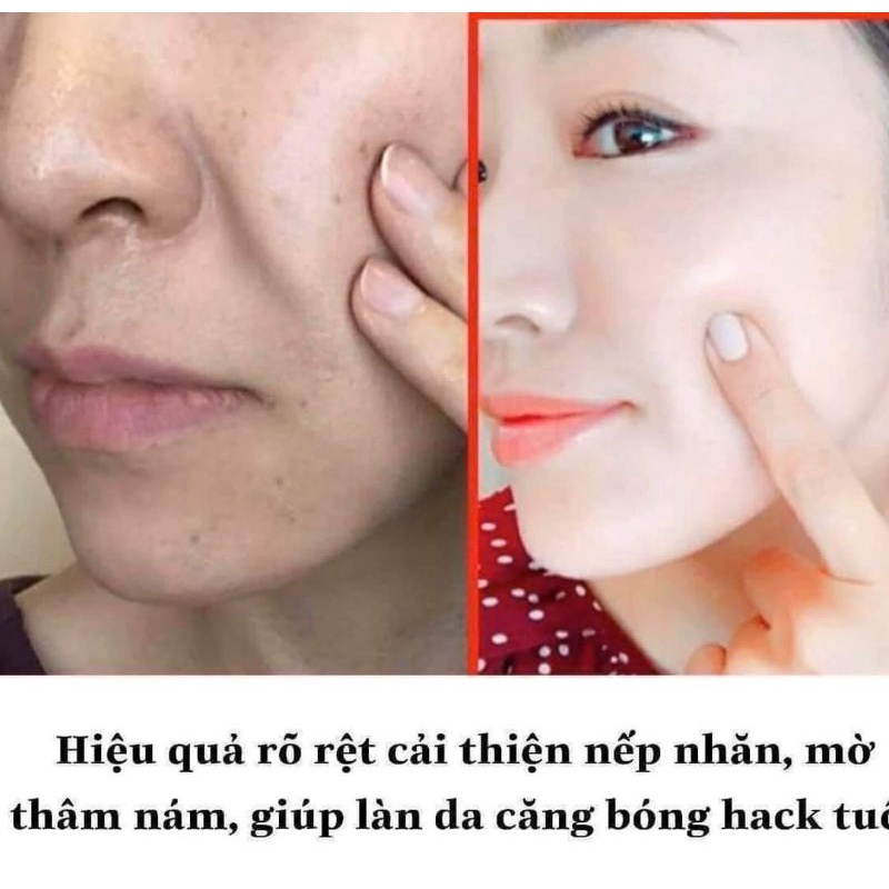 Kem Retinal Đỏ 1% lumiderm