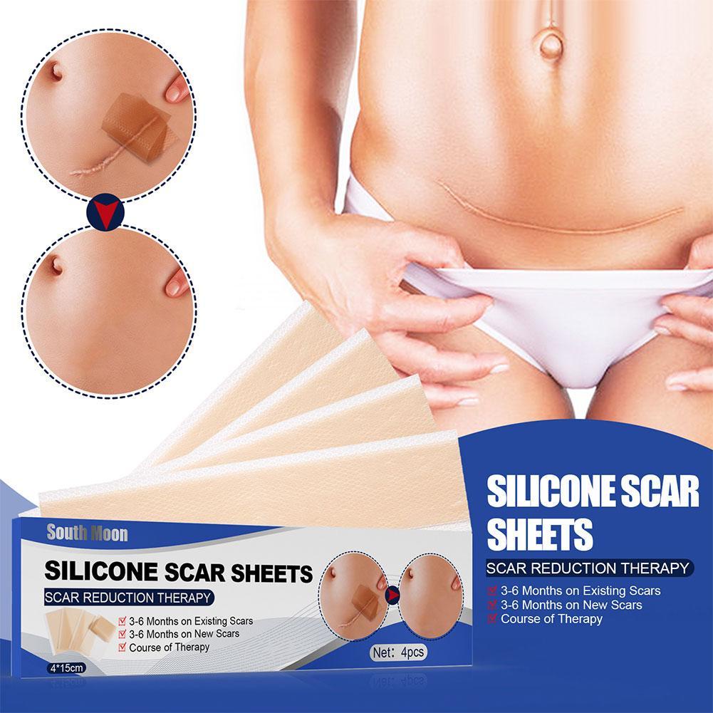 Bộ 4 Miếng Dán Silicone Làm Mờ Sẹo K7I6