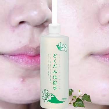 Nước Hoa Hồng Diếp Cá, Tía Tô Natural Skin Lotion 500ml | BigBuy360 - bigbuy360.vn