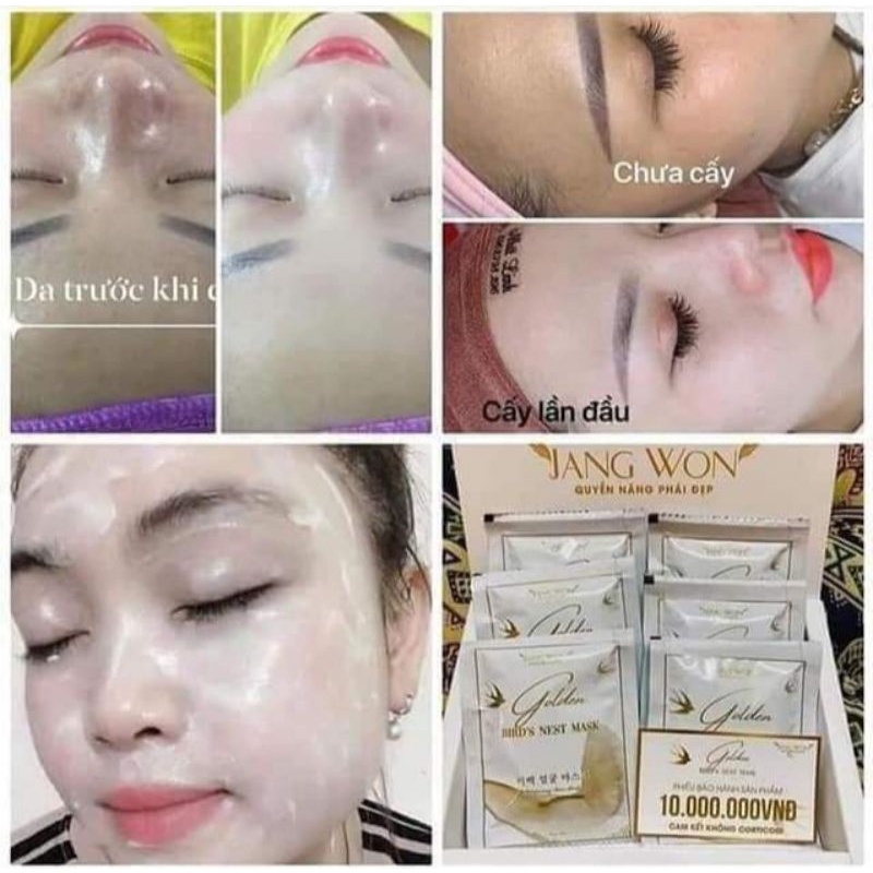 CẤY TRẮNG NẠ YẾN VÀNG