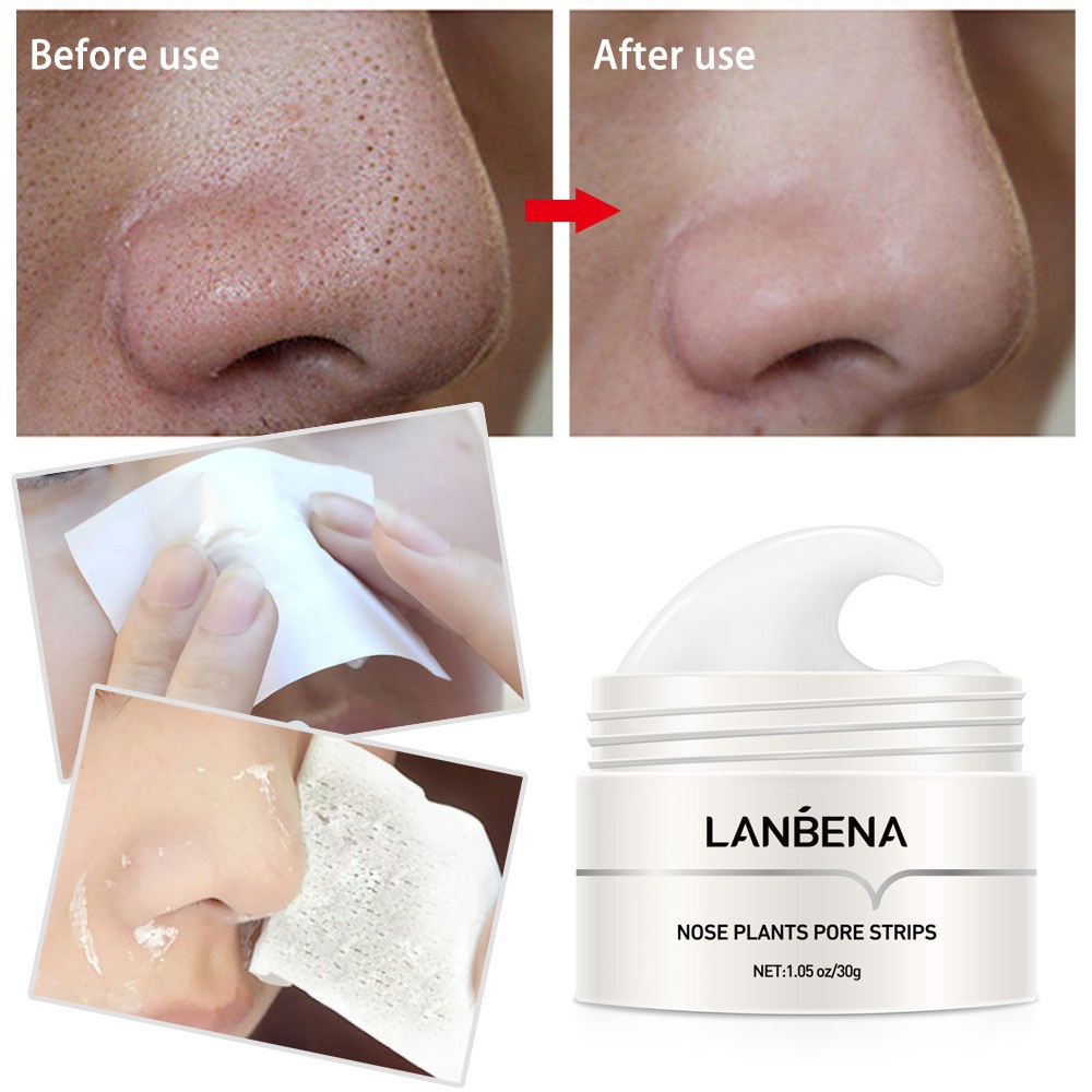 Bộ 3 sản phẩm loại bỏ mụn LANBENA Blackhead Remover Strips/Serum Acne Remover/ Nose Pore Cleaner Facial (Có bán lẻ)