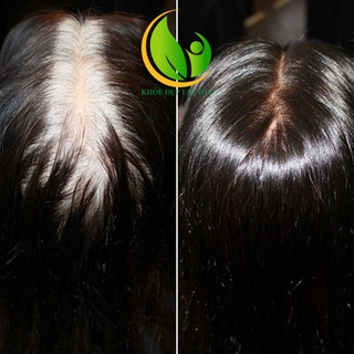 [ CHÍNH HÃNG ] Serum Cỏ Mực Và Đậu Đen Mộc Nhu - 30ml