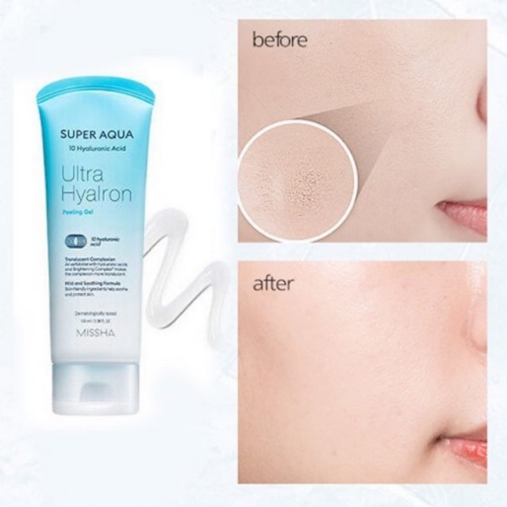 Tẩy Da Chết Missha Super Aqua Ultra Hyalron Peeling Gel 100ml