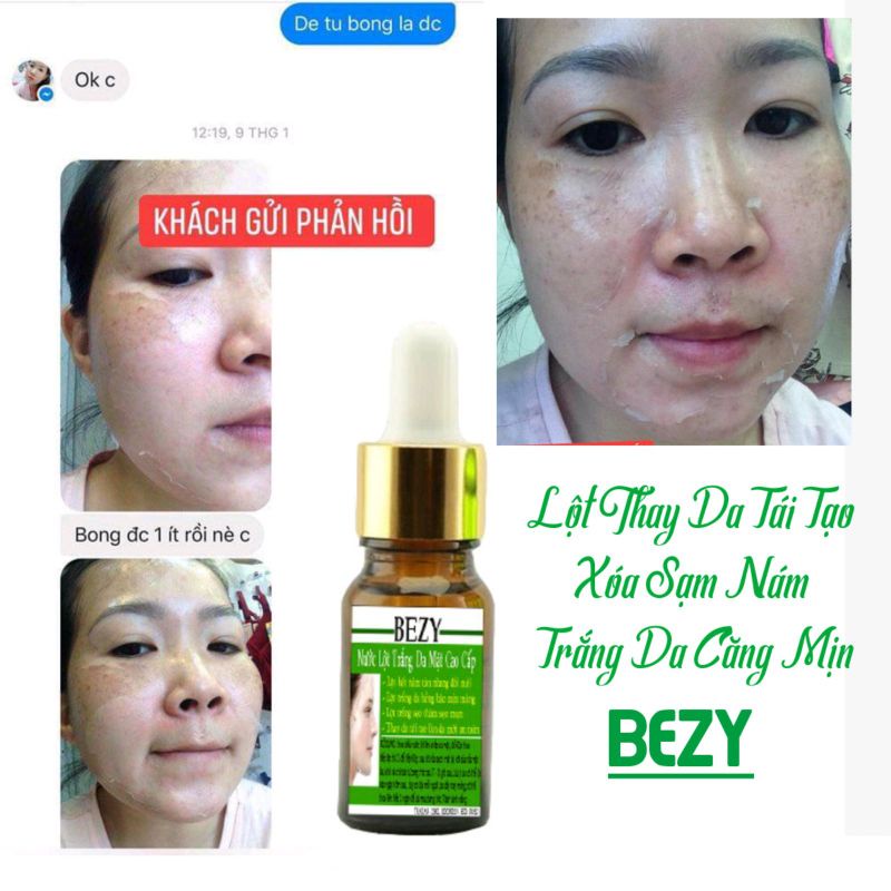 Lột Bong Da Mặt Trắng Da Nam Nữ Bezy