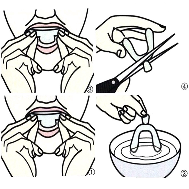 Set 2 dụng cụ niềng răng chuyên dụng cho người lớn