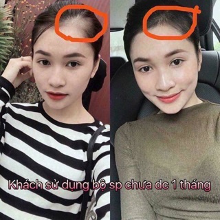 (Giá sốc) Dầu gội trị rụng tóc- kích mọc tóc Amla