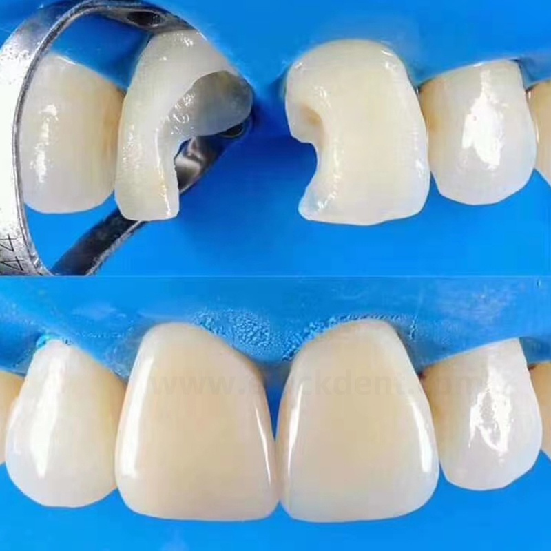 1 Hộp Cao Su Thiên Nhiên Màu Xanh Dương 5*5 Và 6*6 Răng Nha Khoa