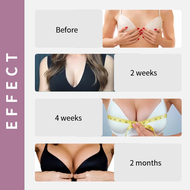 RUOALL Nở Ngực Huyết Thanh 30ML + Kem Set tàn nhang 30G