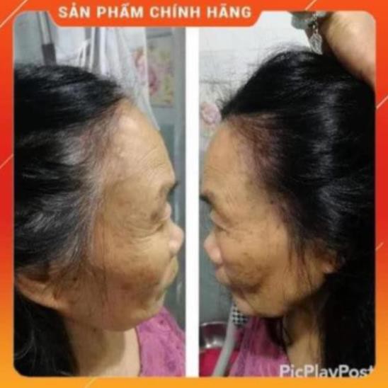 Dầu gội thảo dược phủ bạc đen tóc  lich 5