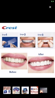 Miếng dán răng Crest 3D White 1-Hour Express bán theo miếng