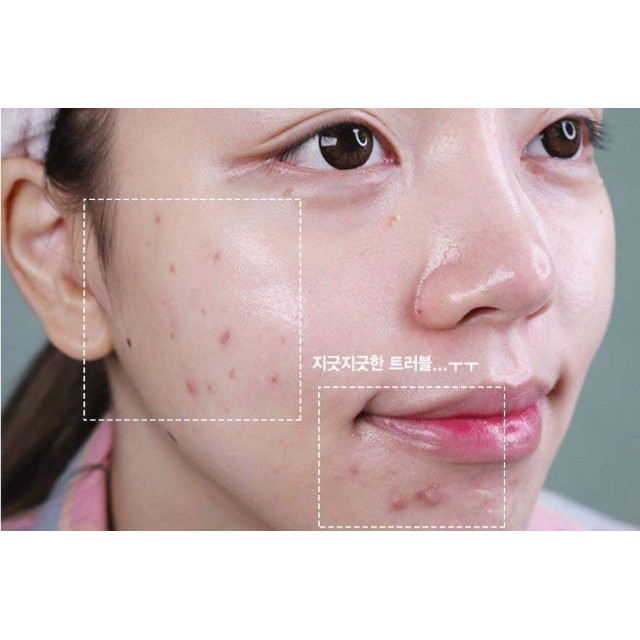 Nước Hoa Hồng Cho Da Mụn Sưng Đỏ Khẩn Cấp Innisfree Bija Trouble Skin 200ml