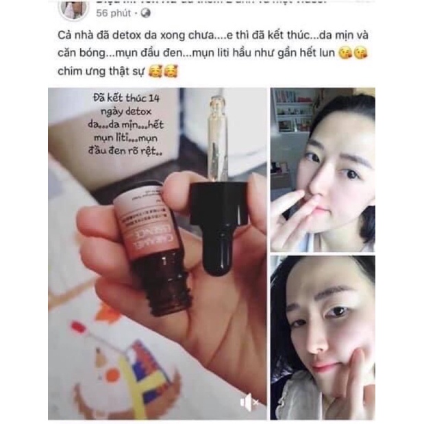 Serum giảm mụn Caramel Essence Nhật Bản , Tinh chất căng bóng , se khít lỗ chân lông to , trắng da
