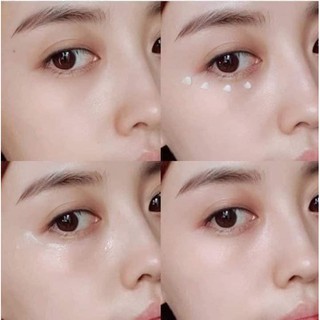 𝐊𝐞𝐦 𝐦ắ𝐭 𝐀𝐇𝐂 𝐑𝐞𝐚𝐥 𝐄𝐲𝐞 𝐂𝐫𝐞𝐚𝐦 𝐅𝐨𝐫 𝐅𝐚𝐜𝐞 𝐋𝐢𝐦𝐢𝐭𝐞𝐝 2019