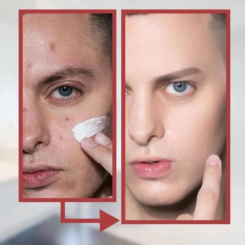 Men's Nourishing Makeup Concealer BB Isolation Cream/Brightens Long Lasting Natural Nude/Waterproof Hydrating Makeup Face Foundation | BigBuy360 - bigbuy360.vn