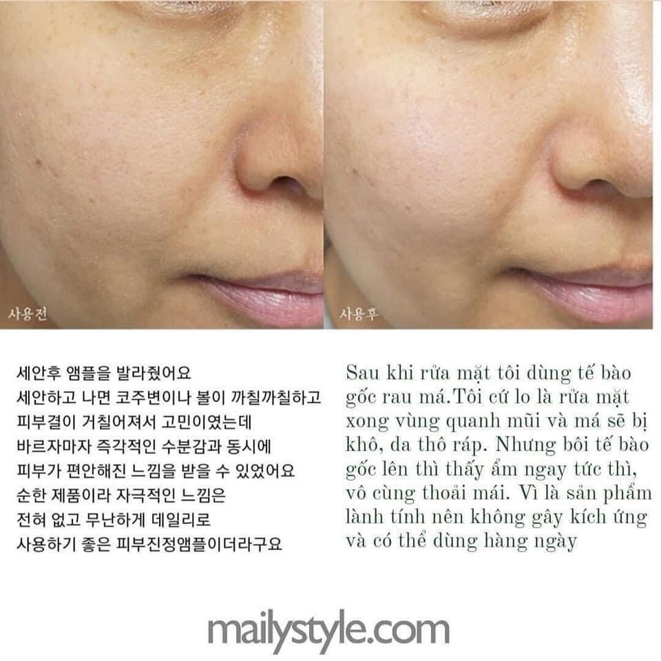 SALE Tinh Chất Rau Má Ample:N Centel Calming Date 04/2024