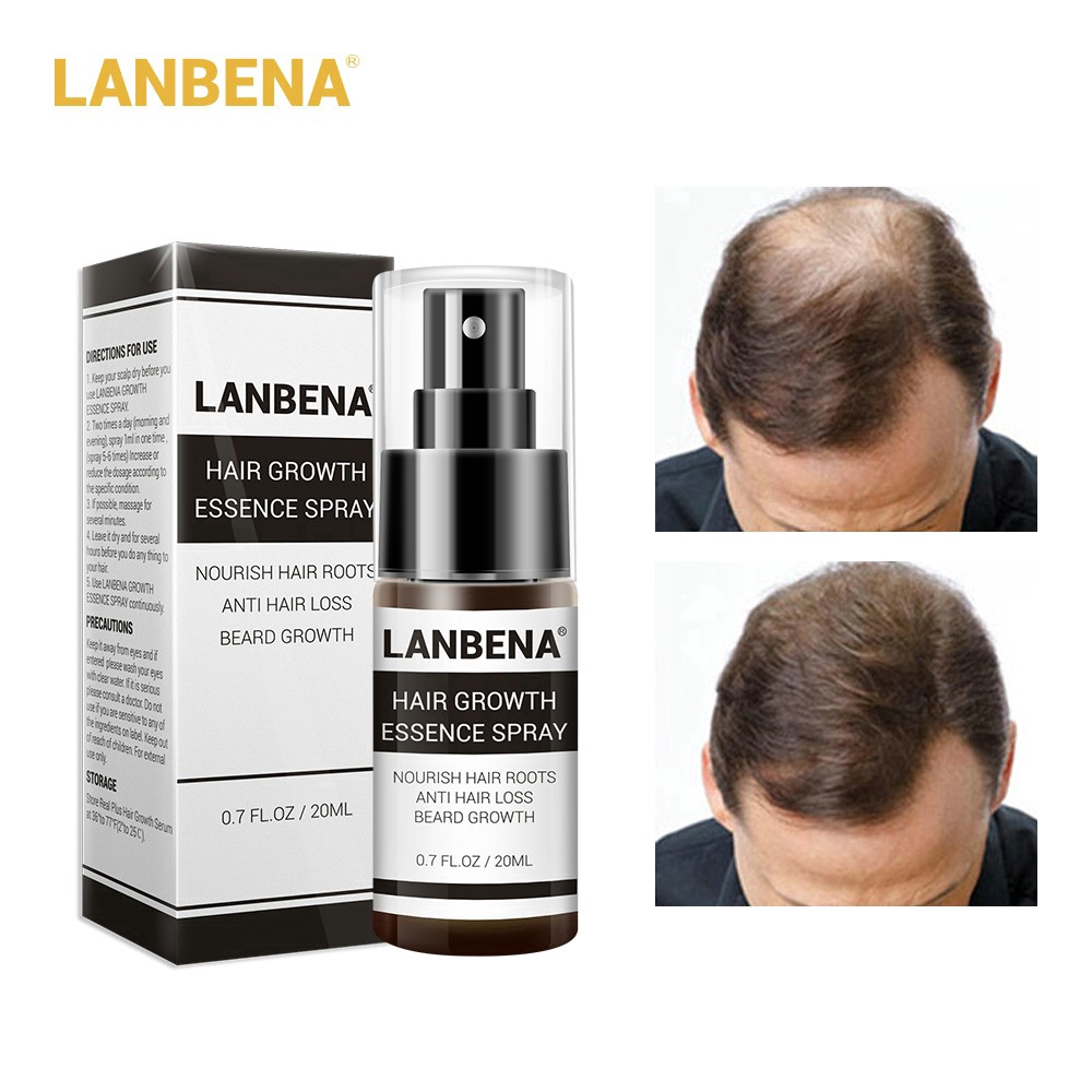 Tinh chất kích thích mọc tóc LANBENA dung tích 20ml