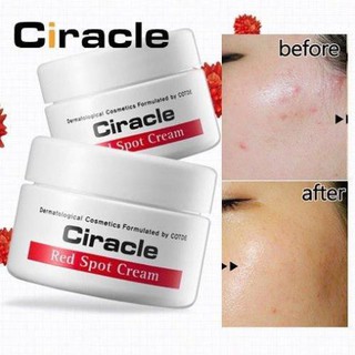 Kem Giảm Mụn Ciracle Red Spot Cream