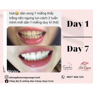 Miếng dán trắng răng Crest Supreme Professional (Trắng rất nhanh) - Combo 7 gói