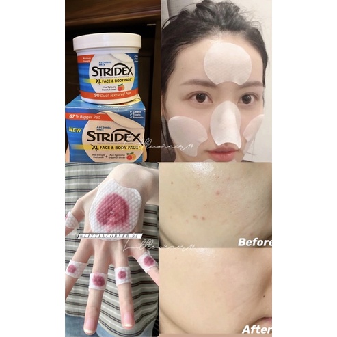 Miếng Pads lau tẩy da chết Face và body Stridex