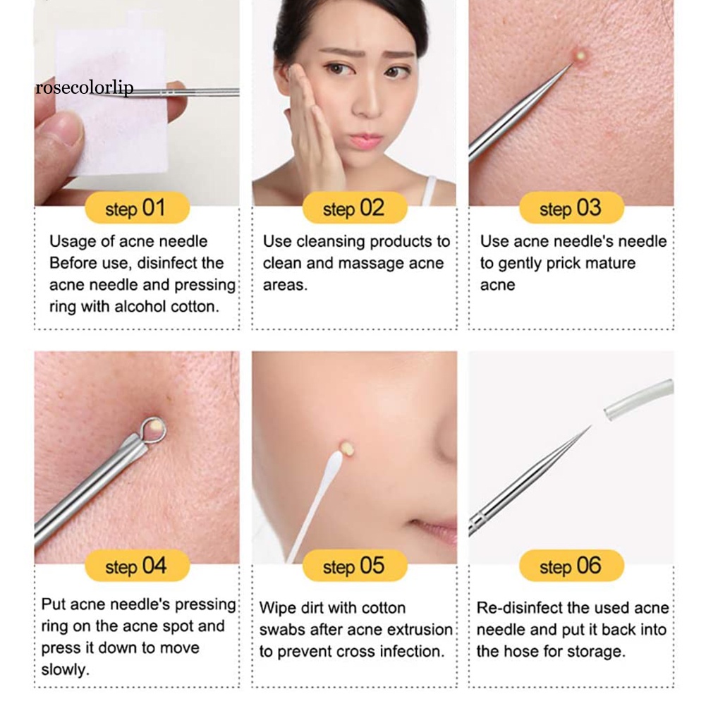 Set 4 Dụng Cụ Nặn Mụn Thân Thiện Với Da