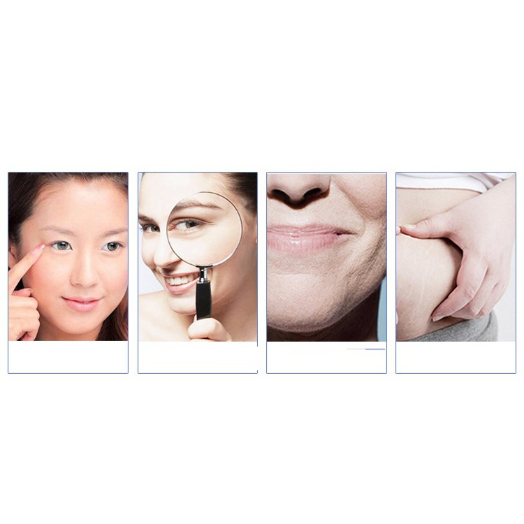 Máy nâng cơ trẻ hóa da xóa nhăn tạo mặt Vline HIFU Vmax