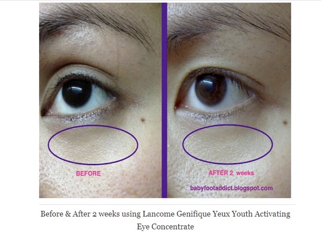 Kem mắt Lancome Genifique Yeux Youth Activating Eye Cream