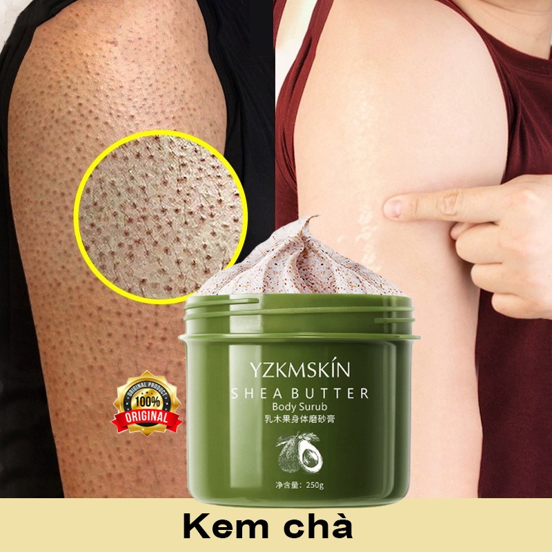 kem tẩy tế bào chết làm trắng da kem loại bỏ lớp sừng chết cơ thể 250g loại bỏ da gà làm trắng dưỡng ẩm chăm sóc cơ thể
