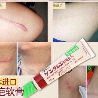 Gel mờ thâm sẹo Gentacin Nhật