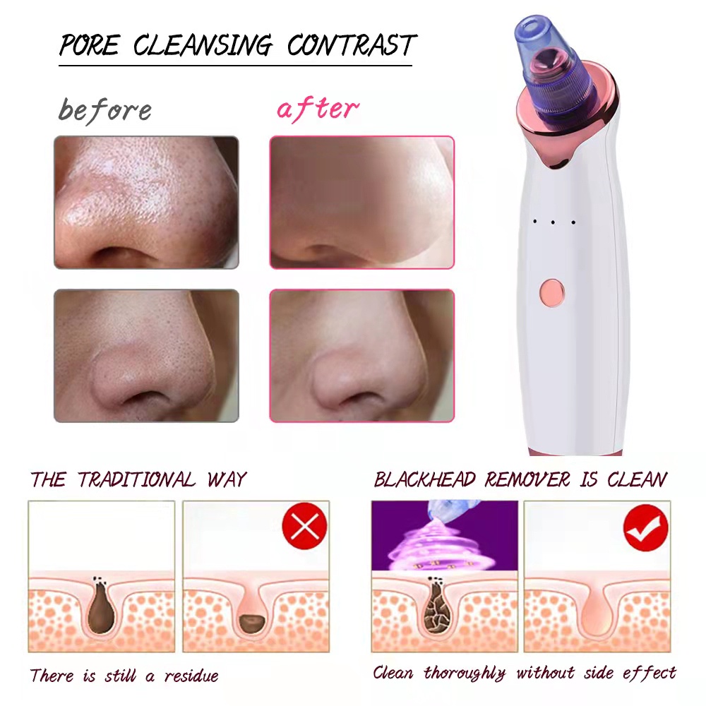 Máy Hút Mụn Đầu Đen Vùng Chữ T Làm Sạch Sâu Lỗ Chân Lông Vùng Chữ T