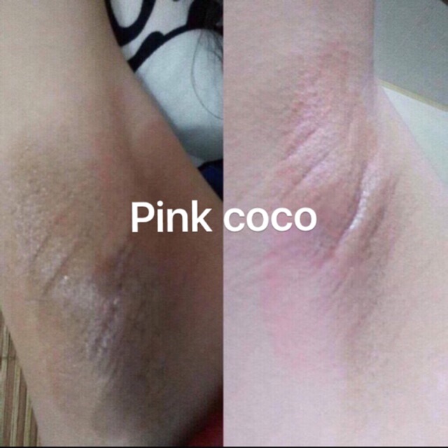 [HÀNG AUTH] Trị thâm nách pink coco