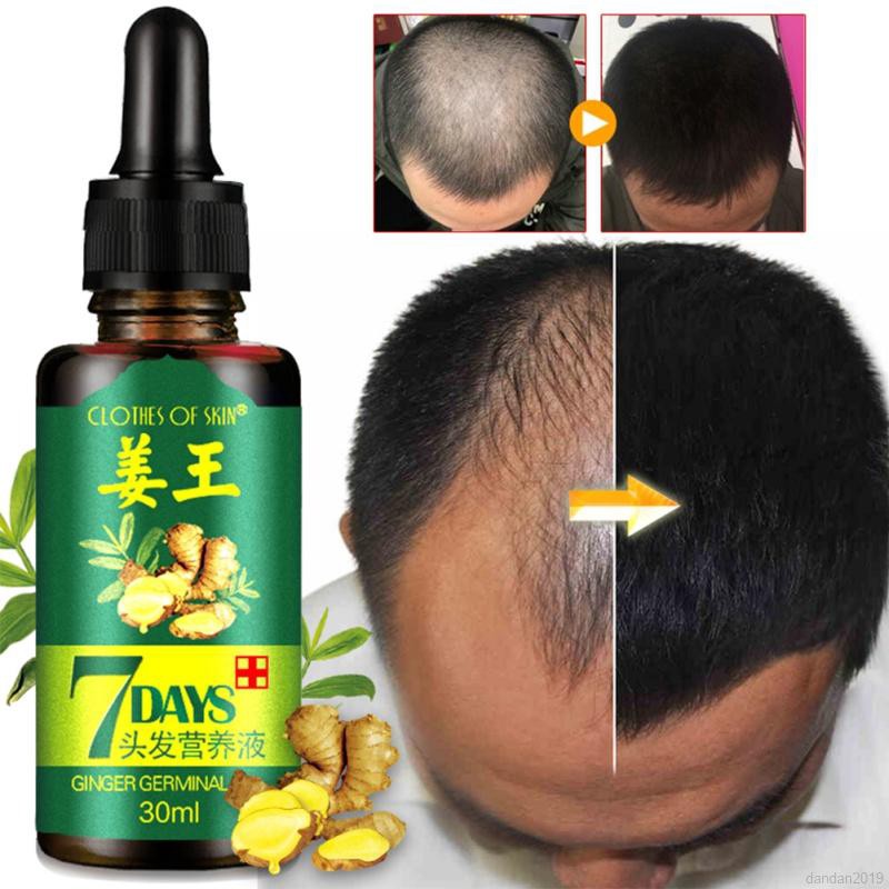 Huyết thanh giúp mọc tóc hương rừng