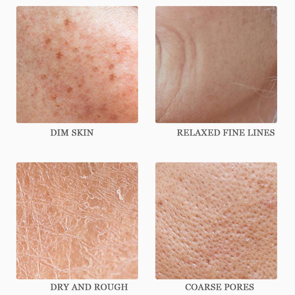 Kem dưỡng da mắt chống lão hóa dưỡng ẩm loại bỏ bọng mắt Astaxanthin | BigBuy360 - bigbuy360.vn