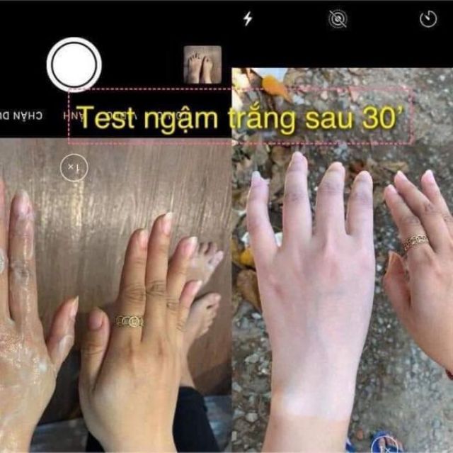 Ngậm trắng dịch yến | BigBuy360 - bigbuy360.vn