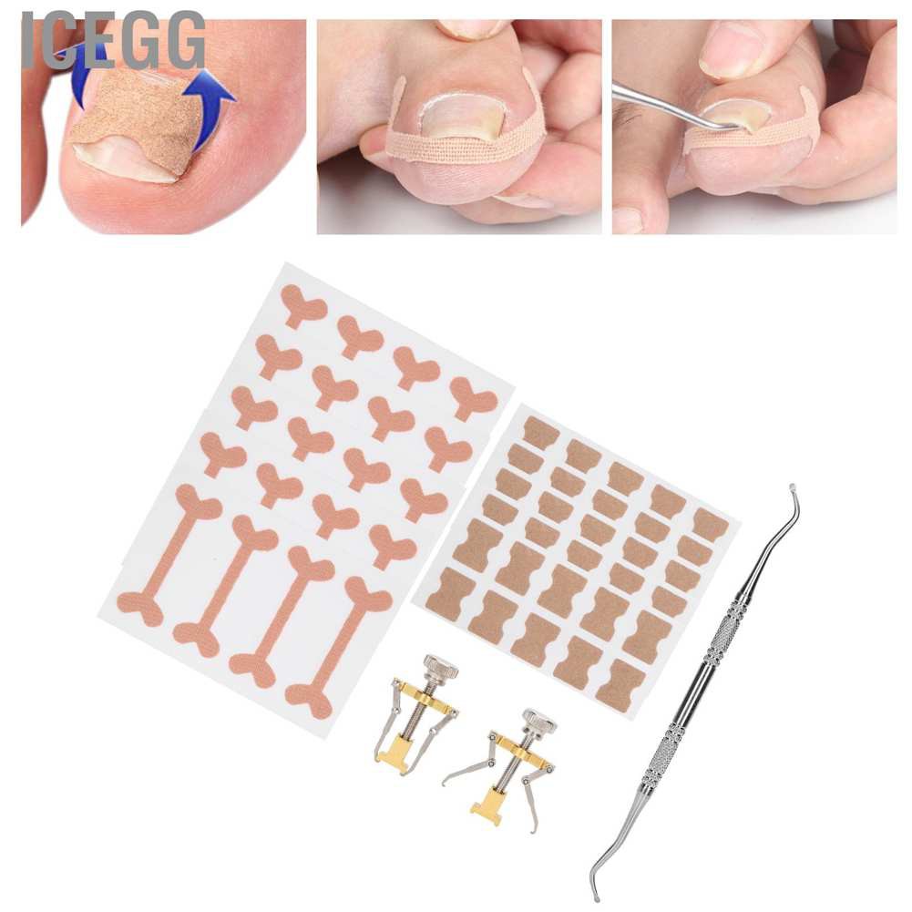 (Hàng Mới Về) Set 13 Dụng Cụ Chỉnh Hình Móng Chân Mọc Ngược Tiện Dụng | BigBuy360 - bigbuy360.vn