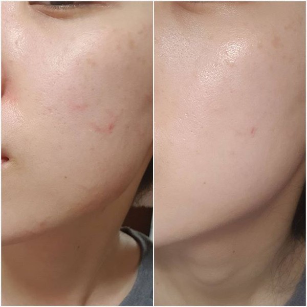 Kem chống nắng Skin1004 Madagascar Centella Air-Fit Suncream